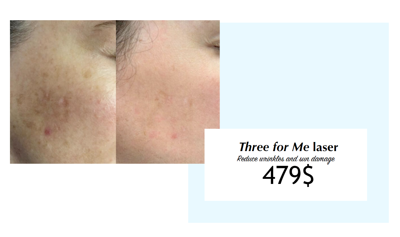 Photo Derma Promotions – Photoderma